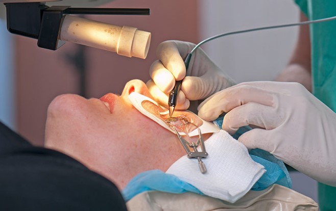 Проведение операции на глазу