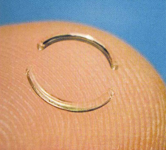 Стромальные кольца