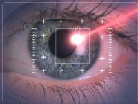 Виды лазерной коррекции зрения